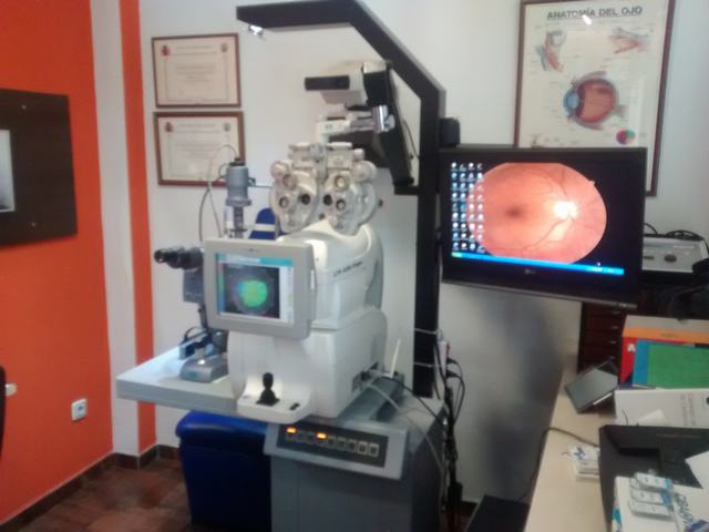 ADMIRA OPTICOS, TELE-OFTALMOLOGÍA, MIOPÍA, ORTO-K, ENFERMEDADES OCULARES, TENSIÓN OCULAR