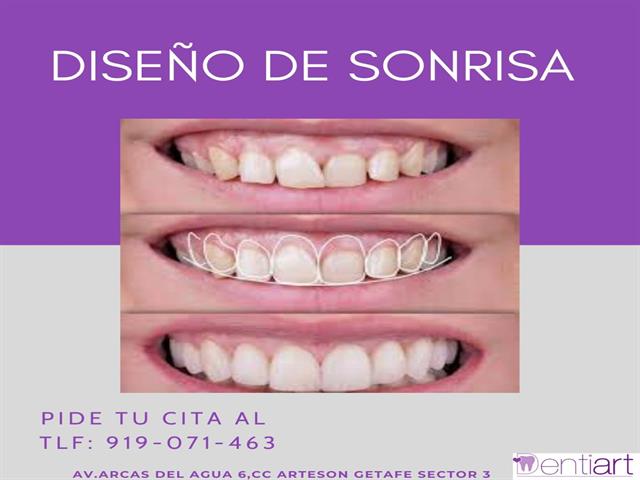 DENTIART CLINICA DENTAL GETAFE